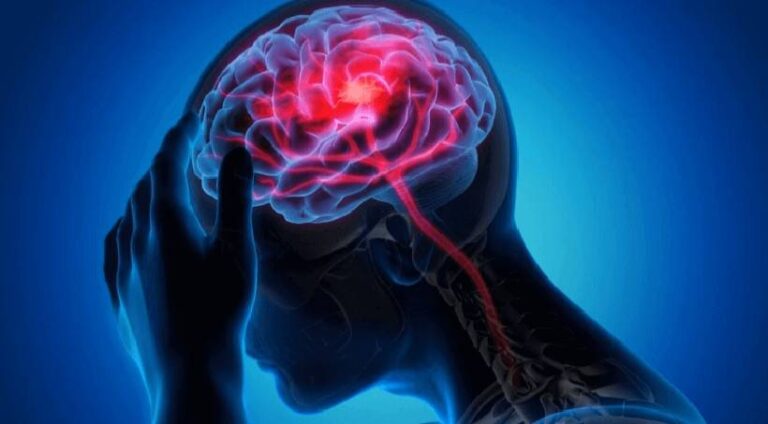 Neurology11